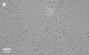 Brightfield imaging of HCT116 cells on Millicell<sup>®</sup> DCI Digital Cell Imager at 20X magnification