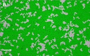 Brightfield imaging of OSUMMER.3 cells on Millicell<sup>®</sup> DCI Digital Cell Imager at 10X magnification with mask