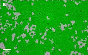 Brightfield imaging of OSUMMER.8 cells on Millicell<sup>®</sup> DCI Digital Cell Imager at 10X magnification with mask
