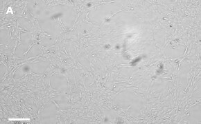 Brightfield imaging of CNS-1 cells on Millicell<sup>®</sup> DCI Digital Cell Imager at 10X magnification