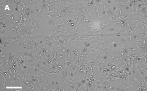 Brightfield imaging of LX-2 Cas9 cells on Millicell<sup>®</sup> DCI Digital Cell Imager at 10X magnification