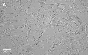 Brightfield imaging of IMR-90 cells on Millicell<sup>®</sup> DCI Digital Cell Imager at 10X magnification