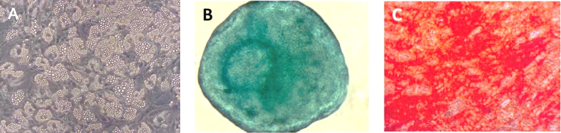 Differentiation of multipotent bone-marrow derived hMSCs into adipocytes, chondrocytes and osteocytes