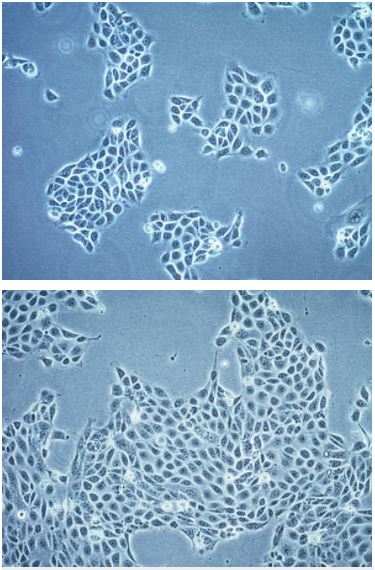 Using Immortalized 16HBE14o- Human Bronchial Epithelial Cell Lines to Model Respiratory Lung Diseases 16HBE14o- cell line-High density human bronchial epithelial cells