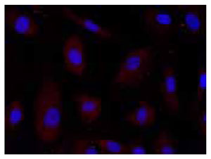 抗-PGAM2 抗-PGAM2