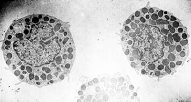 Electron micrograph of mast cells isolated by gradient centrifugation on Percoll Electron micrograph of mast cells isolated by gradient centrifugation on Percoll