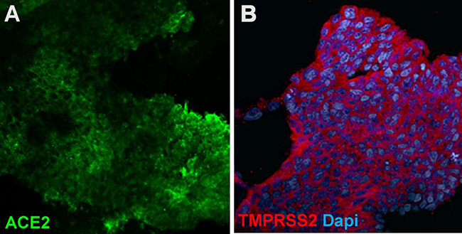 lung-bud-organoids-express-ace-and-tmprss lung-bud-organoids-express-ace-and-tmprss