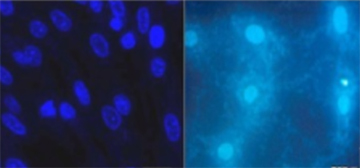 常见的 DNA 检测剂（如 DAPI 或 Hoechst）可利用荧光显微镜显示受污染培养物中支原体的存在（右图）。