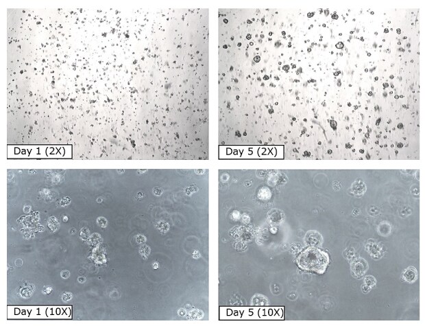 PDAC organoid time course Four microscopy images of pancreatic ductal adenocarcinoma organoids over a 5 day period. The first image shows the organoids at Day 1 at 2X, with small black dots covering the entirety of the image. The second image shows the organoids at Day 5 of growth at 2X magnification, with fewer, larger black circles scattered across the image. The third image shows the organoids at Day 1 at 10X magnification, with small clear circles on a grey image background. The fourth image shows the organoids at Day 5 at 10X magnification, with larger and fewer clear circles on a grey image background.