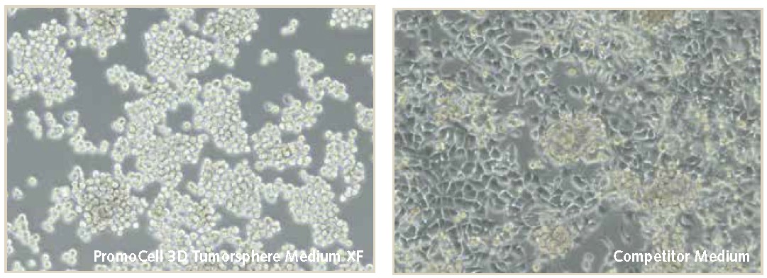 Cell morghology of MDA-MB-231 breast cancer cells during 3D mammosphere culture.