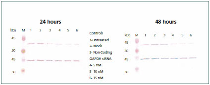 Western blot. Western blot.