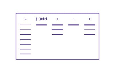 Agarose Gel Electrophoresis Agarose gel electrophoresis