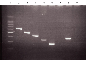 Agaorose gel electrophoresis of RT-PCR products