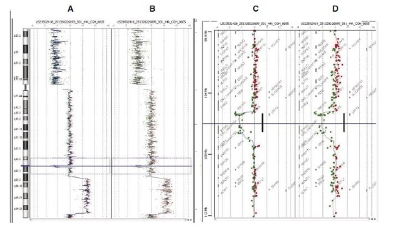 CGH Analytics ideograms illustrating data from Agilent Human Genome CGH 44B microarrays CGH Analytics ideograms illustrating data from Agilent Human Genome CGH 44B microarrays