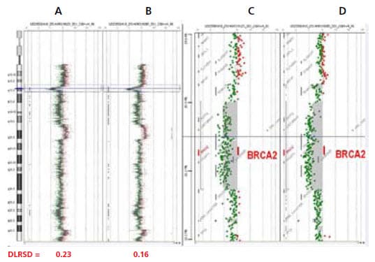 CGH Analytics views of Agilent 244K analyses (5) of a human frozen breast tumor vs. normal female CGH Analytics views of Agilent 244K analyses (5) of a human frozen breast tumor vs. normal female