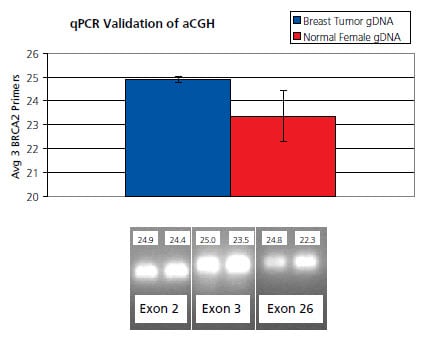 Validation of aCGH breast cancer data using BRCA2 gene-specific quantitative PCR Validation of aCGH breast cancer data using BRCA2 gene-specific quantitative PCR