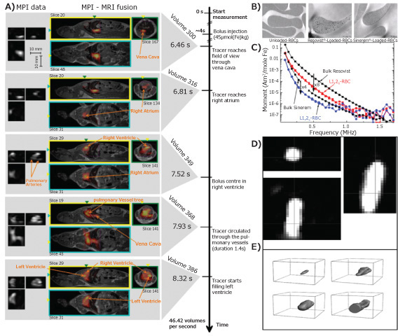 MPI,  MPI-MRI and TEM images