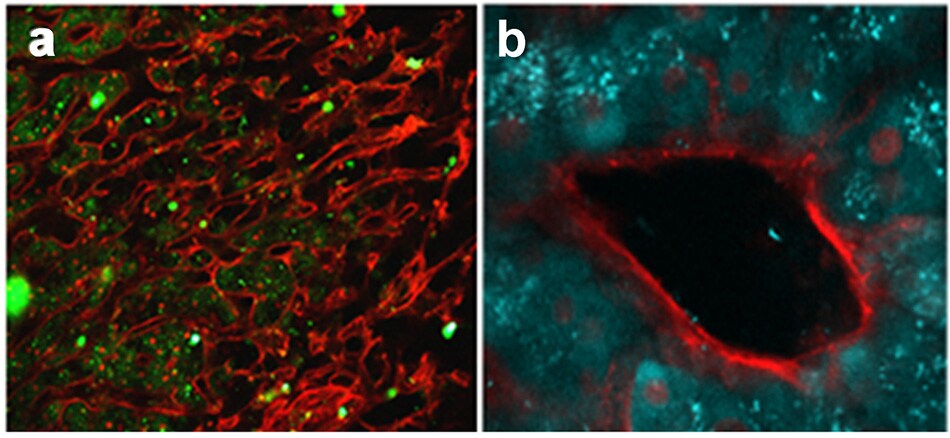 Multiphoton microscopy images of liver Bio-Imaging: Multiphoton Microscopy
