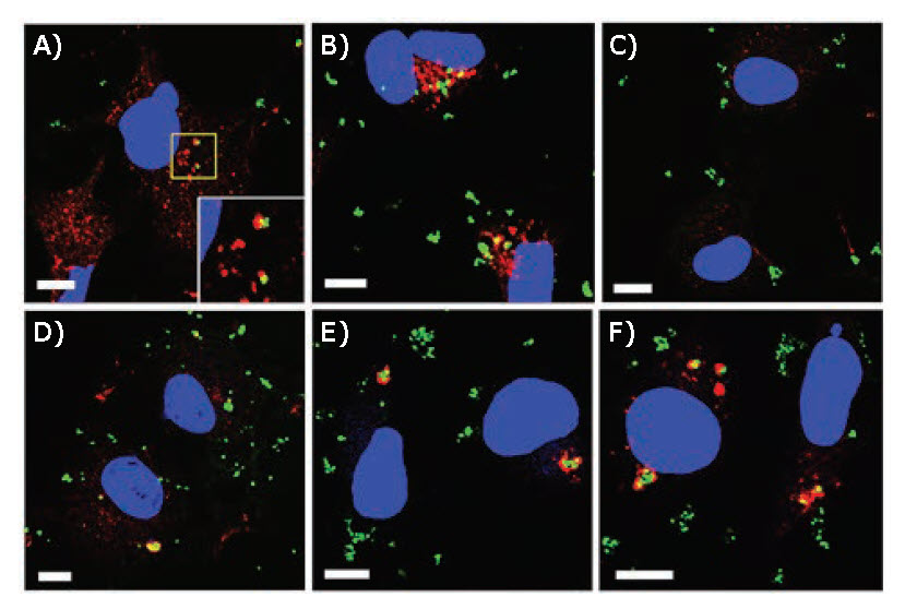 CLSM images of MPNB-transfected COS-1 cells CLSM images of MPNB-transfected COS-1 cells
