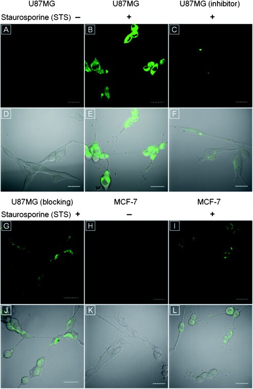 AIE Luminogens: A Family of New Materials with Multifaceted Functionalities CLSM images of (A) healthy and (B) apoptotic U87MG cells upon treatment