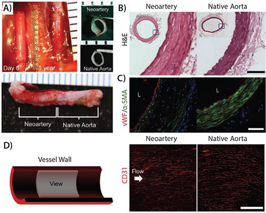 Gross morphology and tissue architecture of neoarteries resemble native arteries Gross morphology and tissue architecture of neoarteries resemble native arteries