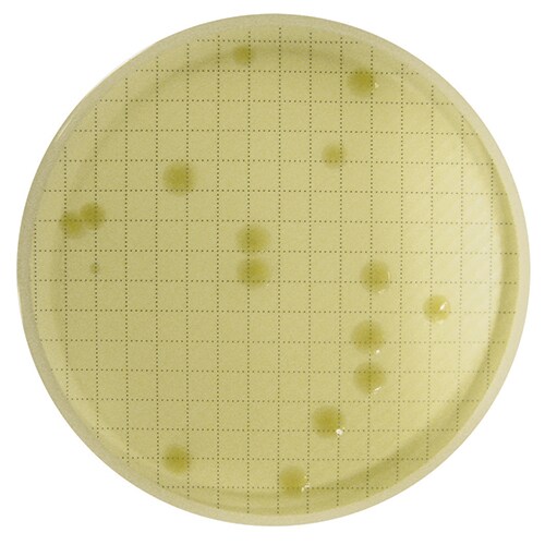 Agar plate with visible bacteria colonies Keywords: Agar Plate, Bacteria, Microorganisms, Colonies, Incubated Reincubated agar plate with visibly grown bacteria colonies