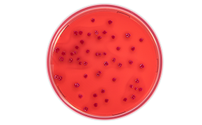 Escherichia Coli Escherichia Coli
