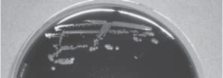 Detection of Campylobacter spp. and Enterobacter Sakazakii in Food with a New Test Kit System Campylobacter jejunii colonies grown on CCDA agar
