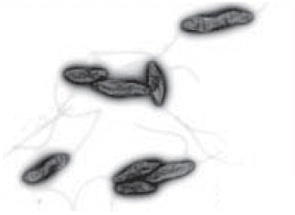 Electron microscope image of Campylobacters Electron microscope image of Campylobacters