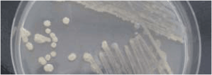 Detection of Campylobacter spp. and Enterobacter Sakazakii in Food with a New Test Kit System Enterobacter sakazakii colonies grown on M1 agar