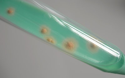 Mycobacteria Colonies On TB-Medium TB 培养基上的分枝杆菌菌落