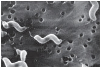 Scanning electron micrograph Scanning electron micrograph