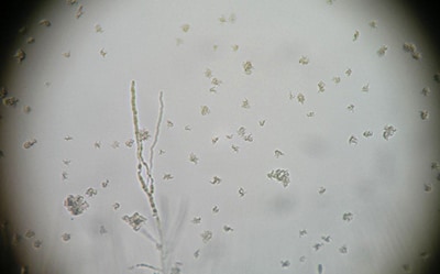 Typical Colony Mycobacterium Tuberculosis 典型的结核分枝杆菌菌落