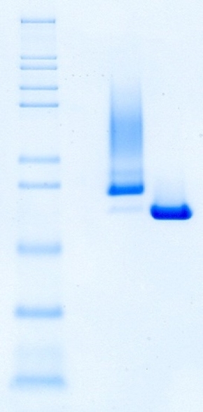 非还原性SDS-PAGE下，Benzonase®耐盐内切酶的一致性和纯度优于竞品A。