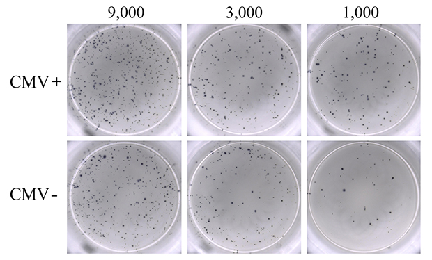 ELISpot assay using 0.3 µM ionomycin + 0.2 µM PMA to stimulate IFN-γ secretion from PBMCs. ELISpot assay using 0.3 µM ionomycin + 0.2 µM PMA to stimulate IFN-γ secretion from PBMCs.