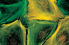 Double labeling of Mouse aorta cells with FITC-Phalloidin and Monoclonal Anti-α-Smooth Muscle Actin