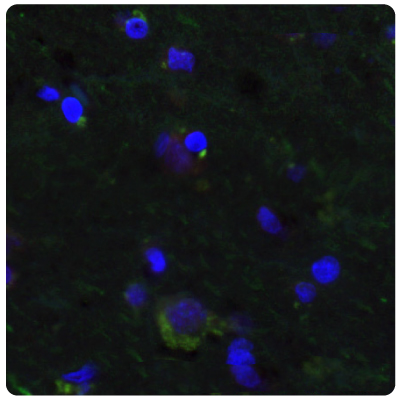 Human Normal Cortex IHC-IF Staining with Anti-SALL4 and Anti-PTEN Antibodies Multiplexed IHC-IF staining of human normal cortex samples using Anti-SALL4 monoclonal (Product No. AMAb91769) and Anti-PTEN monoclonal (Product No. AMAb91736) antibodies.