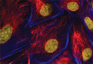 Immunofluorescence. Imna(-/-) mouse embryonic fibroblasts stained with Monoclonal Anti-Vimentin Immunofluorescence. Imna(-/-) mouse embryonic fibroblasts stained with Monoclonal Anti-Vimentin