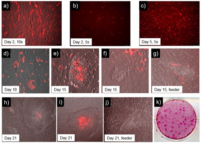 Time-course-human-iPSC-fig6 Time course of human iPSC colonies