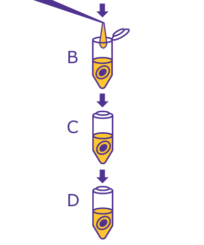 2nd step of the In-Solution Deglycosylation workflow starting with adding denaturant and incubating then cooling to room temp. 2nd step of the In-Solution Deglycosylation workflow starting with adding denaturant and incubating then cooling to room temp.