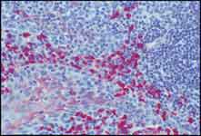 Colorimetric immunohistochemical detection of Alkaline Phosphatase Colorimetric immunohistochemical detection of Alkaline Phosphatase