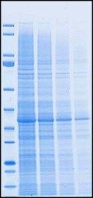 Gel electrophoresis with mPAGE™ Bis-Tris Precast Gels Competitor T 50-minute run time