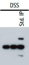 Western Blot Analysis of Immunoprecipitation (IP-Western) In a cross-linking IP western, the heavy and light chains of the primary capture antibody are excluded from the sample.