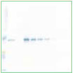 Western Blotting and Immunohistochemistry Western Blotting and Immunohistochemistry
