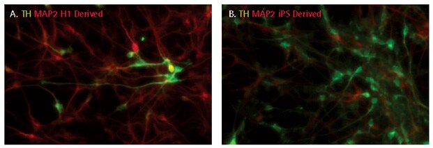 Dopaminergic differentiation of iPSC derived NPCs Dopaminergic differentiation of iPSC derived NPCs