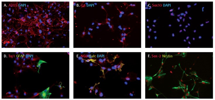 Oligodendrocyte differentiation of iPS cell derived NPCs Oligodendrocyte differentiation of iPS cell derived NPCs