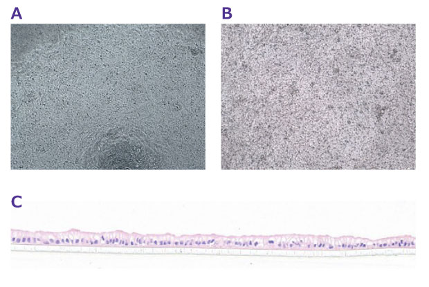 Confluent organoid monolayer on inserts