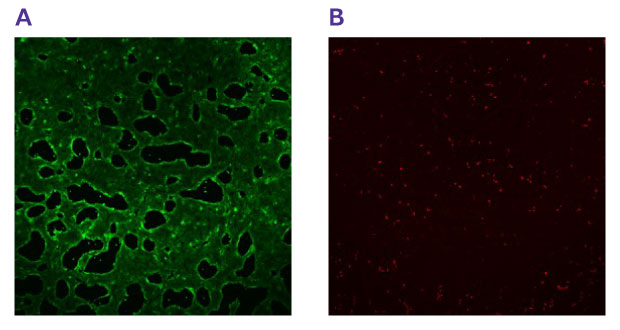Live cell staining on hiPSC colon cells