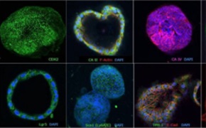 Human Gastro PDO A 2-by-3 grid of fluorescent micrographs showing cellular structures against a dark background. The panels feature varying colors (green, blue, magenta, cyan, and red).