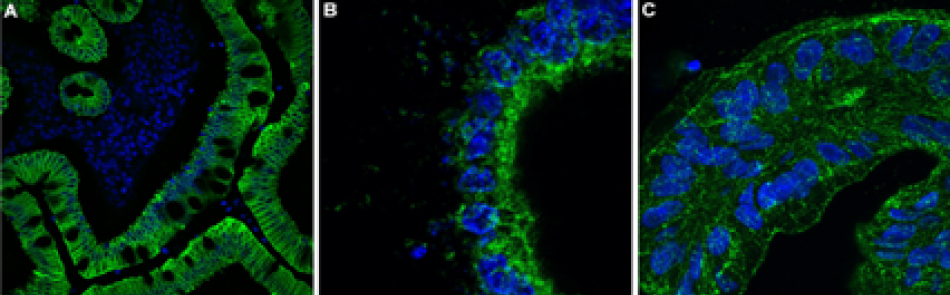 All three images show thick lines of cytoplasmic and membranous staining for the organoid sections along with small ovals within the thick lines that represent the nucleus.